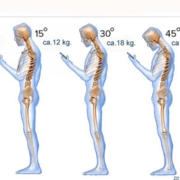 Smartphones giver ondt i ryggen